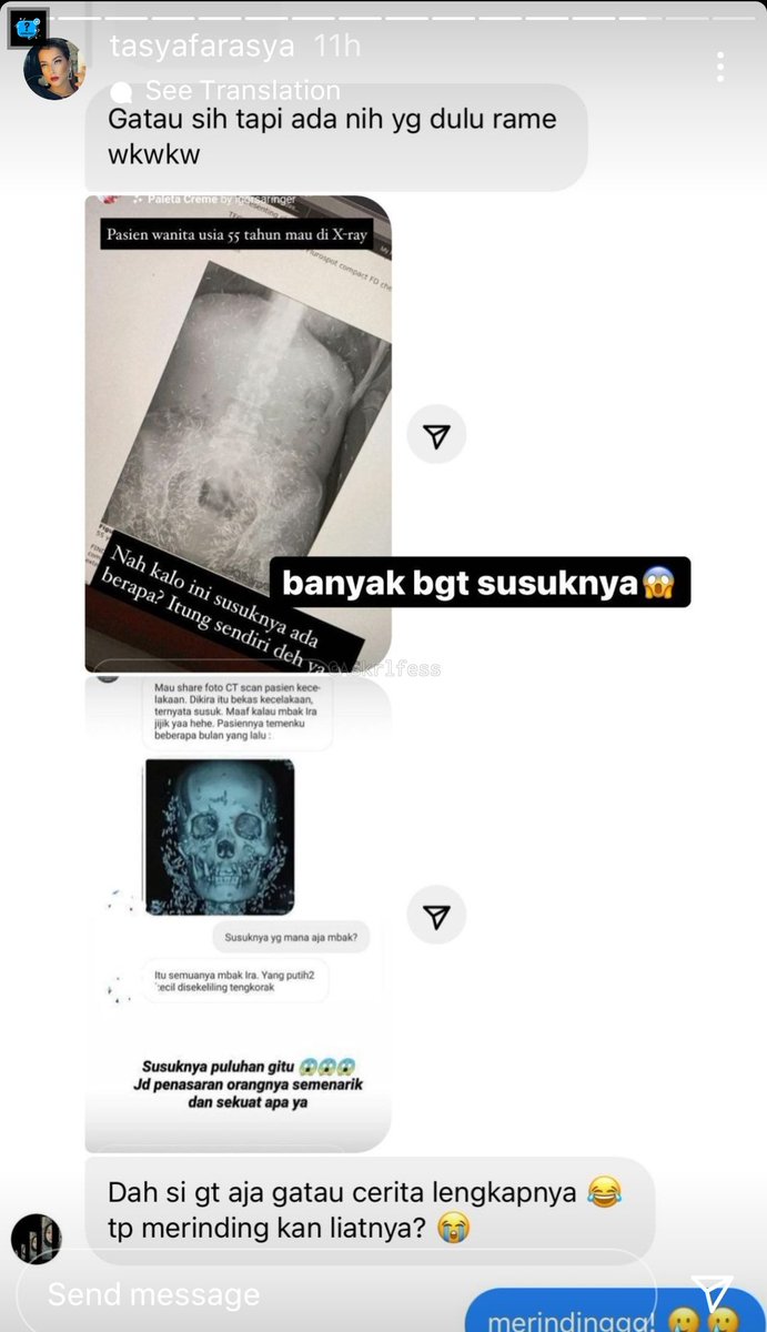 Askrlfess's tweet photo. [askrl] !!! HOROR !!!

kalian punya cerita seputar susuk ga? Ceritain dong, lagi suka bacanya 😱 https://t.co/SUqeD9ChxB