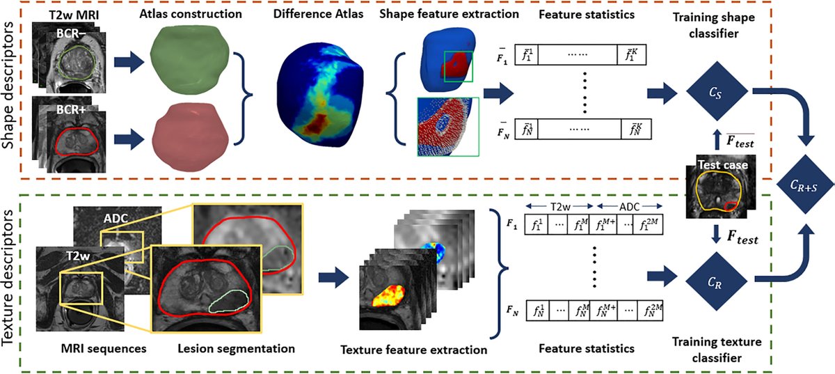 📢 NEW PAPER 📢 

"Prostate Surface Distension and Tumor Texture Descriptors From Pre-Treatment MRI Are Associated With Biochemical Recurrence Following Radical Prostatectomy: Preliminary Findings" led by Rakesh Shiradkar is out now in <a href="/FrontOncology/">Frontiers - Oncology</a>.

bit.ly/3z364QE