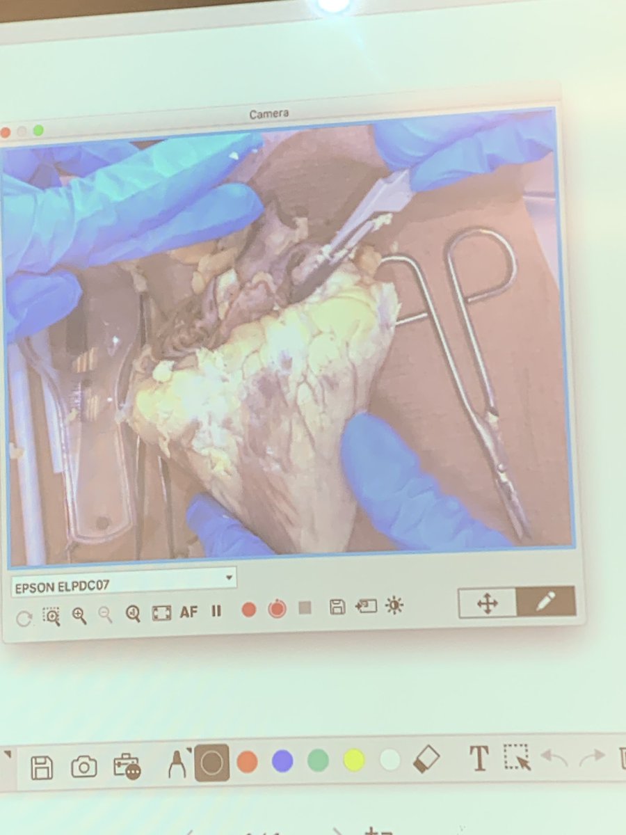 BohayJulie's tweet image. Sc8 has their hands on some hearts today! 🫀
#futurecardiologists 
#becurious
@RundleJrHigh