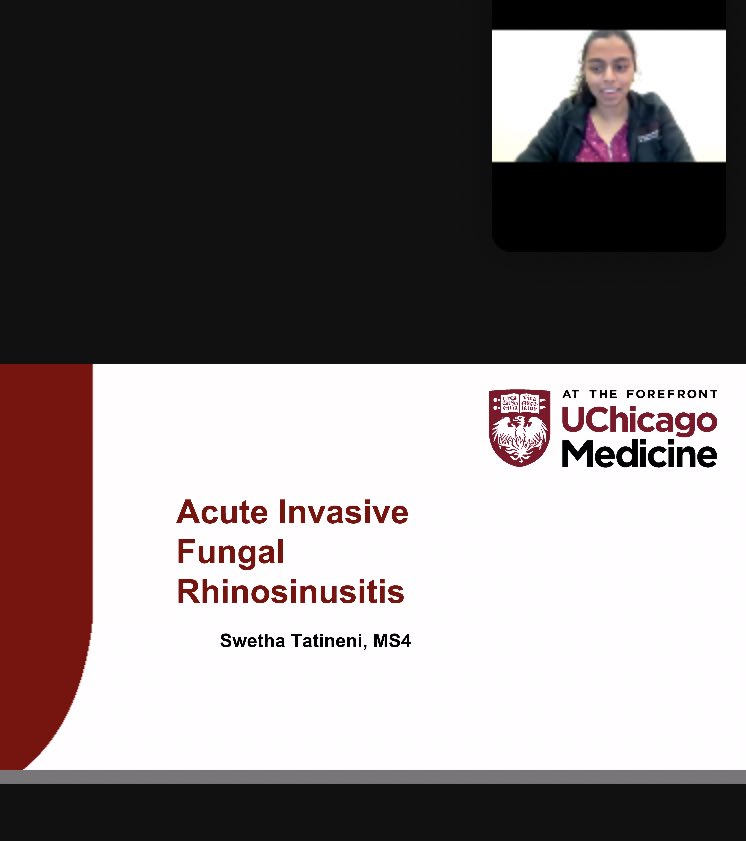 UChicagoOHNS's tweet photo. Our @UChiPritzker acting interns @SwethaTatineni and @Amaratti presented their #grandrounds tonight as they wrapped up their month with us!  Congrats and great job! 👏🏻🎊🥳 #MedTwitter #ENT #MedEd #IamOto https://t.co/WvuZFzuAUK