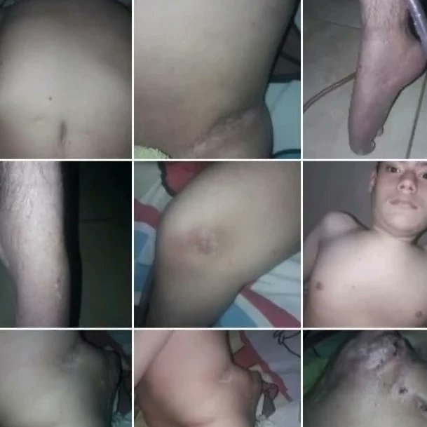manuel02101's tweet photo. BUENO HASTA ACÁ LLEGÓ MI LÁSTIMA EN TWITER, HICE TODO PARA QUE SE ME AYUDARA,NO TUVE RESPUESTAS DE NADIE, SI TENGO QUE MORIR,MORIRÉ,NO ME IMPORTA YA ,HE LUCHADO DURANTE 18 AÑOS ,YA ESTA BUENO DE SUFRIMIENTO Y HUMILLACIÓNES :ATTE MANUEL RIBEIRO. BENDICIONES 🙏❤🇻🇪 https://t.co/wTHbZGOdGY