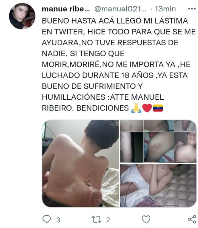Particularmente yo m deslindó d todo color político y pido la colaboración d todos en #Twitter para q visibilizemos el caso d <a href="/manuel02101/">Manuel Ribeiro (Manuelito ❤️)</a> aquí no c vale la política quien pueda ayudar con un #RT el lo agradecerá tenemos q hacerlo llegar a quien sea q lo ayude
#MiClapProductivo