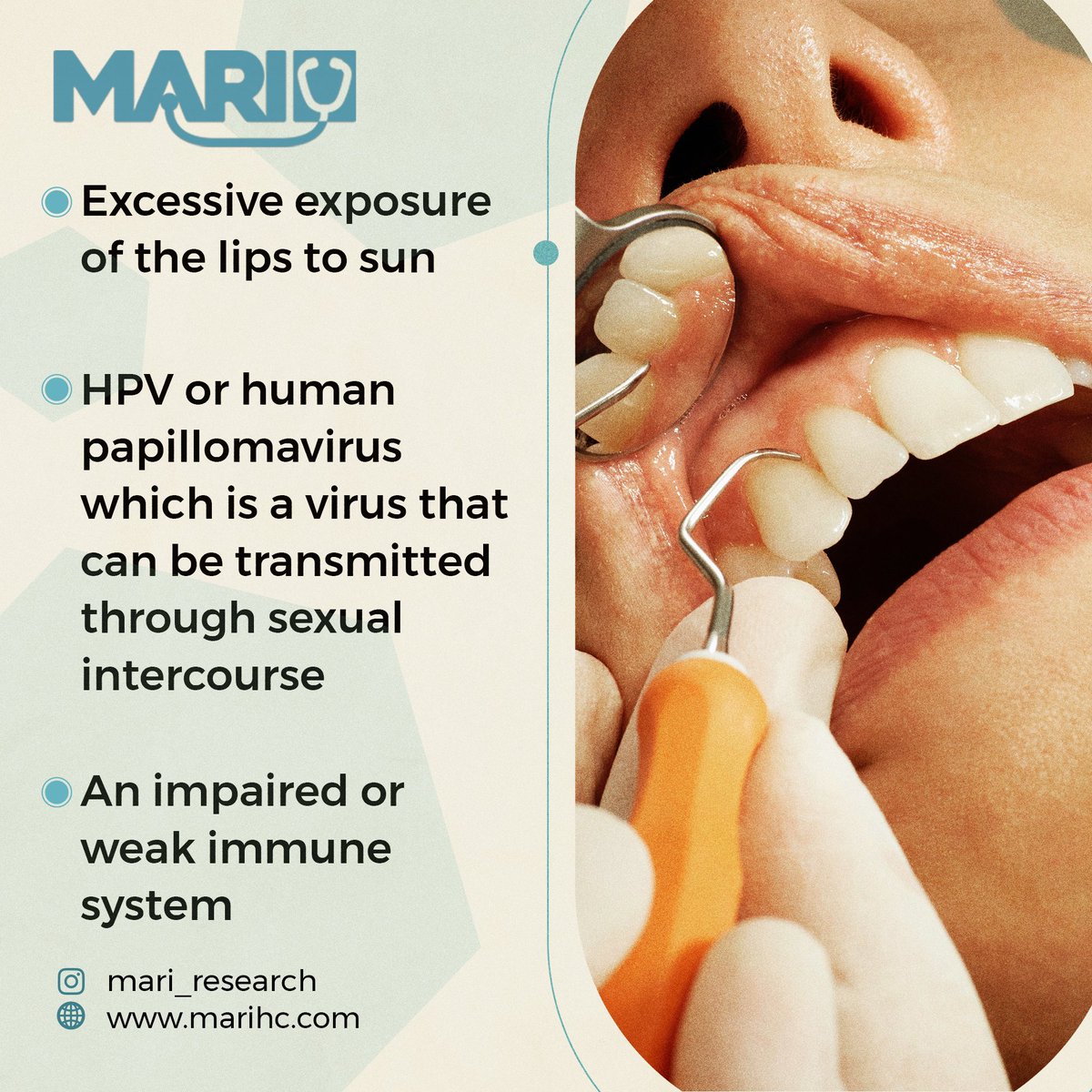 mari_research's tweet photo. Mouth #cancer or #Oral cancer all refer to the same condition which is mainly occurring in the #mouth. In this type of #cancer, cancerous cells start growing or dividing mainly in the tissues of the mouth or #throat. #MARI #lifestyle https://t.co/kHD0duGPAC