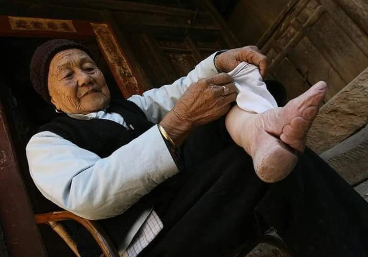 tHeSuperSaid's tweet photo. Foot Binding was a Chinese tradition in the 1940’s to make women appear ‘more beautiful’ to men. #ToeJam #HammaTime #Bunions https://t.co/YnrRhWiR90