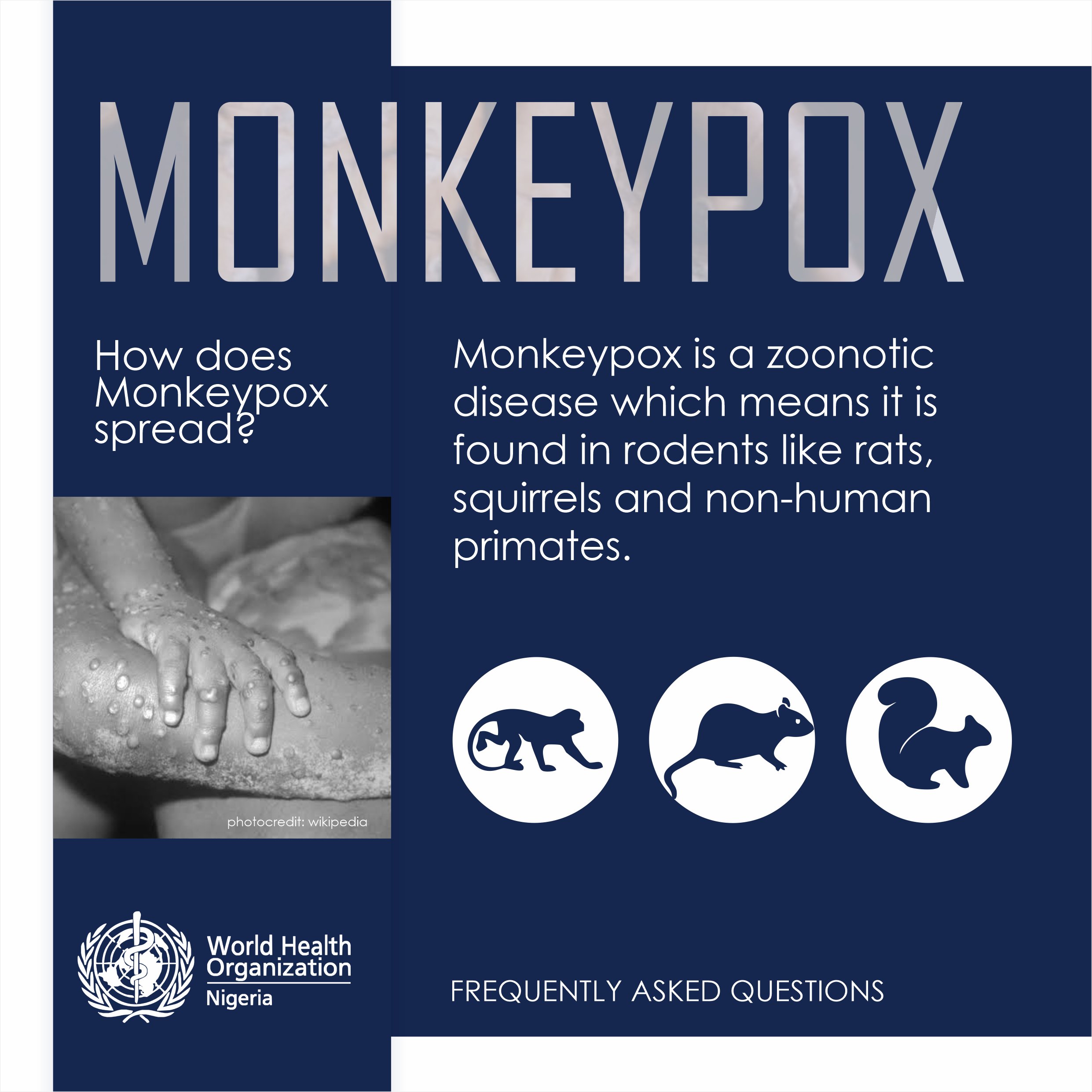 Monkeypox virus - Wikipedia