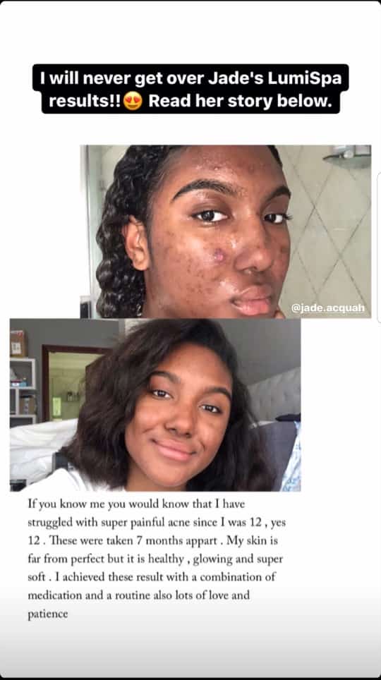 RadiantBeauty19's tweet image. Lumispa beauty skincare device

-💯 deep cleanse and draws out the impurities
-💯 even skin tone 

📲 Whatsapp 0795561274
. 
#HMWinterEssentials