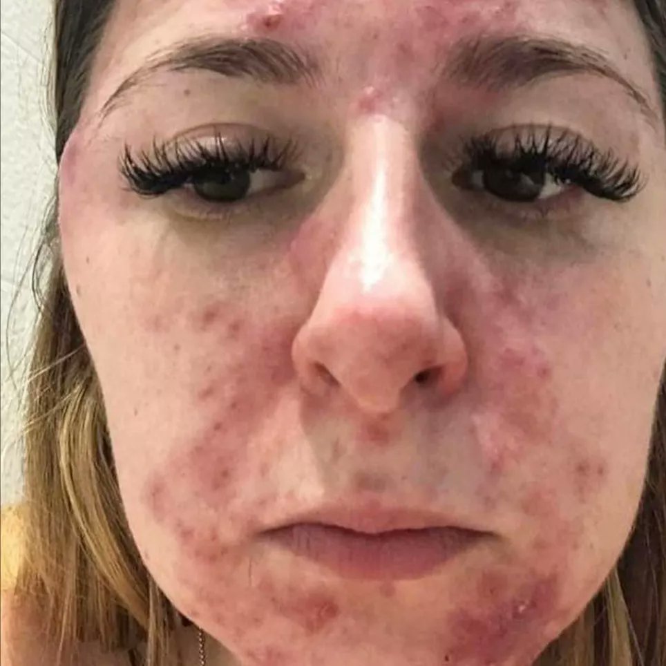 RadiantBeauty19's tweet image. Lumispa beauty skincare device

-💯 deep cleanse and draws out the impurities
-💯 even skin tone 

📲 Whatsapp 0795561274
. 
#HMWinterEssentials