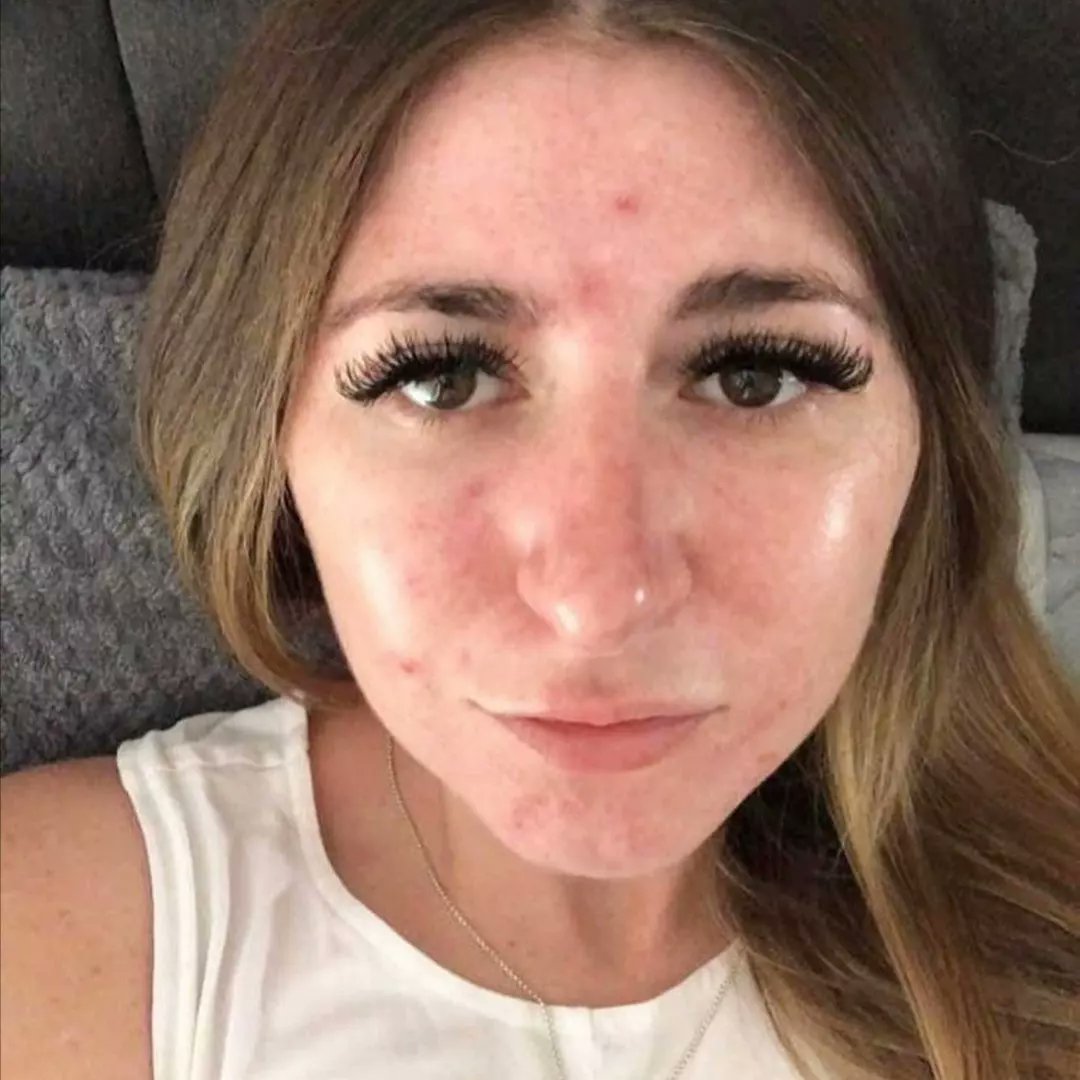 RadiantBeauty19's tweet image. Lumispa beauty skincare device

-💯 deep cleanse and draws out the impurities
-💯 even skin tone 

📲 Whatsapp 0795561274
. 
#HMWinterEssentials