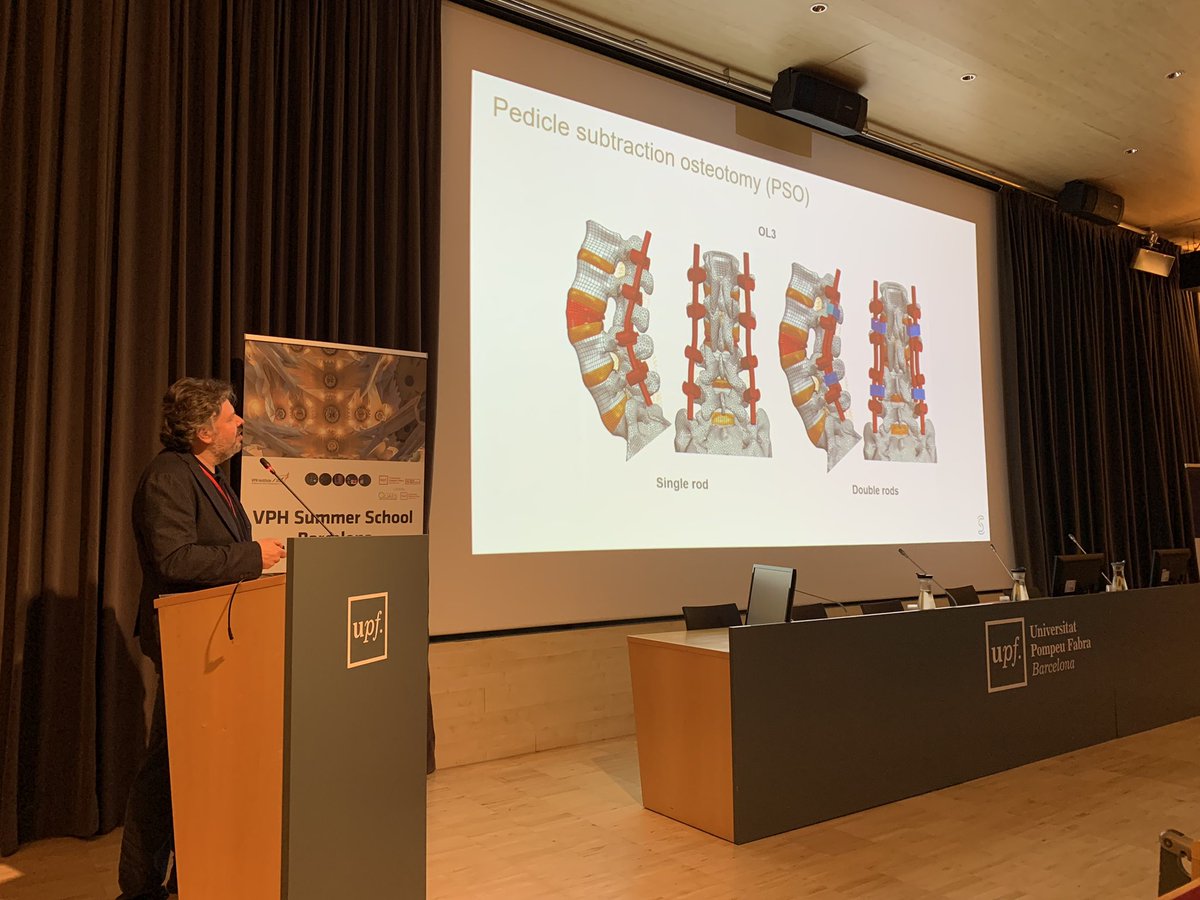 bcnvph's tweet image. Yesterday, Fabio Galbusera from @SchulthessNews delighted us with a fantastic overview of #FiniteElement modelling in #spine #orthopaedics, including a historical overview and current use for #surgery planning and #prognosis, and #implant assessment