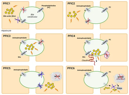 Biomed_MDPI's tweet photo. 💡How could liver-targeted gene therapy be a potential new therapeutic approach for both acquired and genetic cholestatic diseases? Check out the latest review by @MartnezGarcia_J @AngieMolinaD @ggasegui @webernick #CristianSmerdou @CIMA_unav 
🔗https://t.co/VHvhU9NdaV https://t.co/cMR4rmxoke