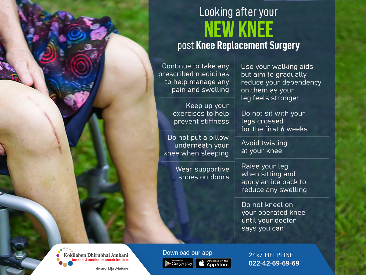 KDAHMumbai's tweet photo. After you have knee replacement surgery, you will have to be cautious about how you move about for the next few weeks. Follow these expert-recommended guidelines to help improve the recovery process and prevent any injuries. #kneereplacementsurgery #tipoftheday #recoverytip https://t.co/2FjAYY2j2C