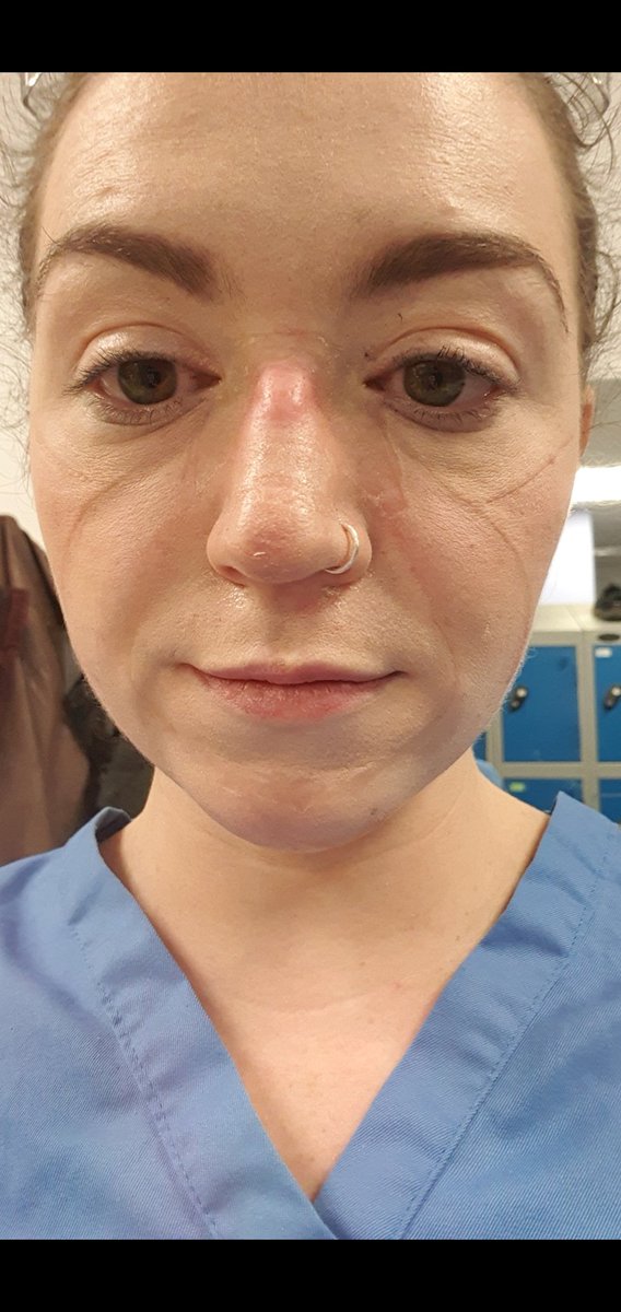 Niamh_F_Kielb's tweet photo. Beginning of Wave 2. Living with undiagnosed PTSD & depression. Not sleeping due to crippling nightmares of my parents/family/friends dying on our COVID ITU. Did I party? No. I contemplated jumping in front of a train to stop it all.
#covid #westayedhome https://t.co/zPt1UhGgvN