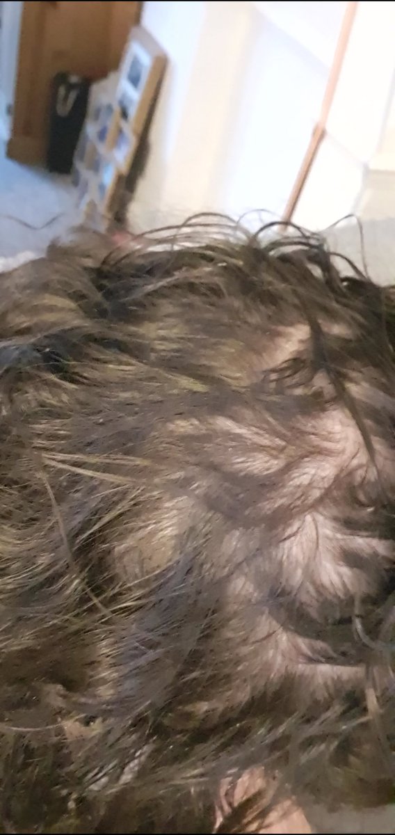Niamh_F_Kielb's tweet photo. Beginning of Wave 2. Living with undiagnosed PTSD & depression. Not sleeping due to crippling nightmares of my parents/family/friends dying on our COVID ITU. Did I party? No. I contemplated jumping in front of a train to stop it all.
#covid #westayedhome https://t.co/zPt1UhGgvN
