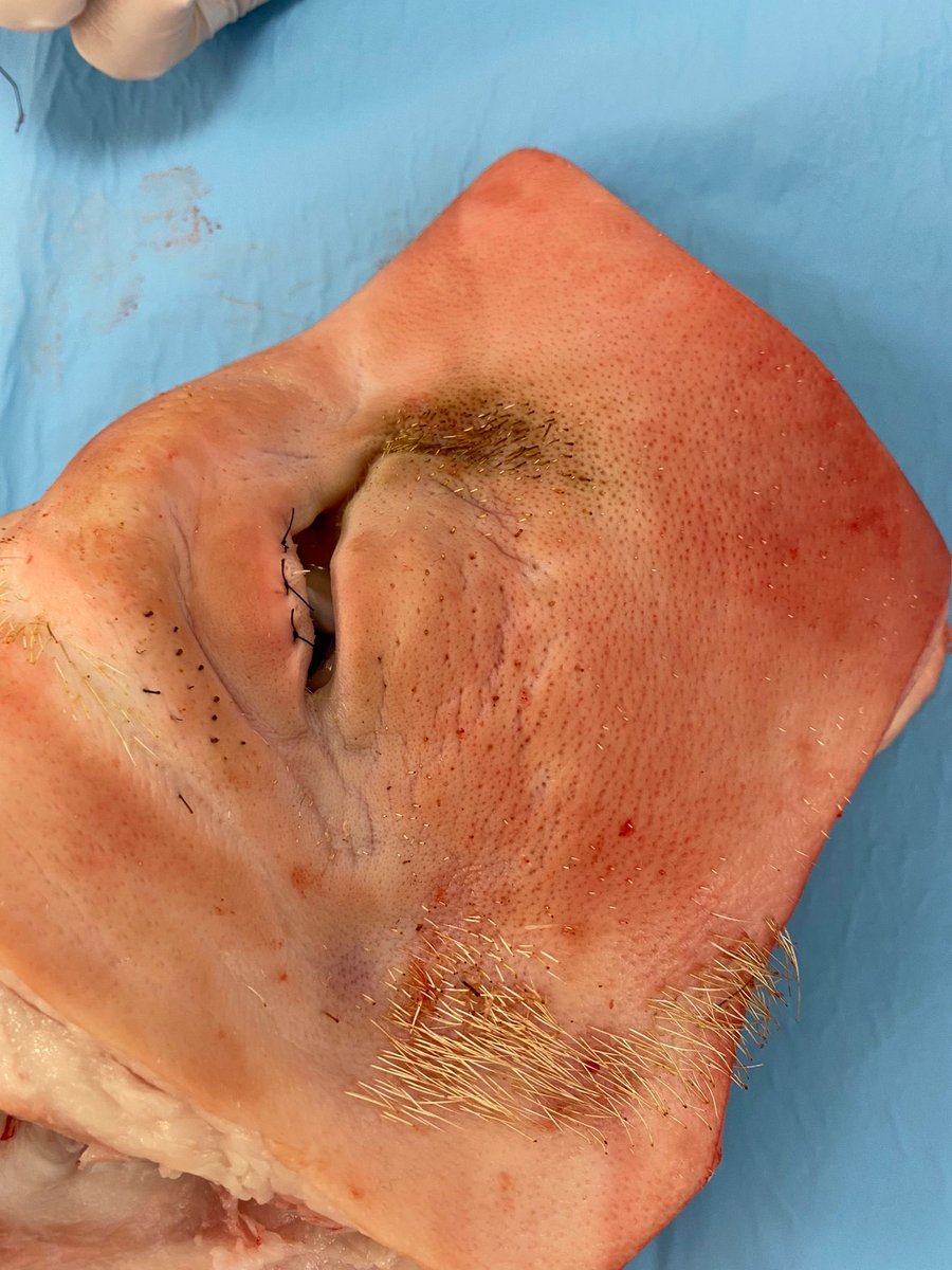 eSaludate's tweet photo. Hoy tenemos el 2º viernes del Curso Cirugía Oculoplastica (técnicas avanzadas) en el Centro Tecnológico de Simulación.
#oculoplastia #cirugia #oftalmology https://t.co/clsHJspHUG
