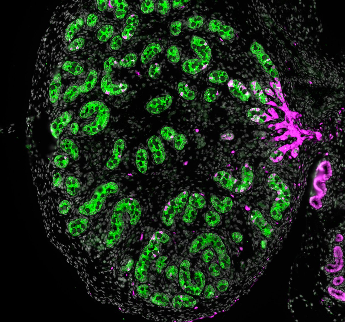Our new paper is published today in Science Advances:
Origin, specification and differentiation of a rare supporting-like lineage in the developing gonad"

Want to know more about the origin of rete testis and rete ovary? Go to: science.org/doi/10.1126/sc…