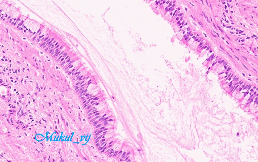 Hi #pathtwitter
Pediatric liver lesion
What do you think
#liverpath #pedipath