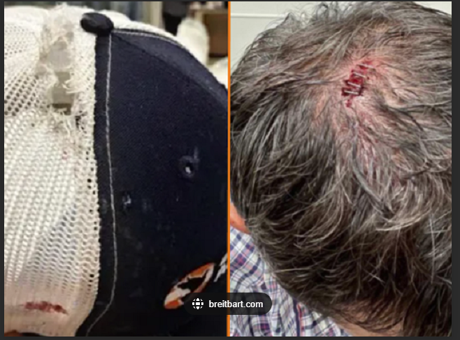 littlenewsnetwk's tweet photo. @thecomfyfren he had a very close call, bullet went through the hat but just grazed him. https://t.co/OrklDrLdP2