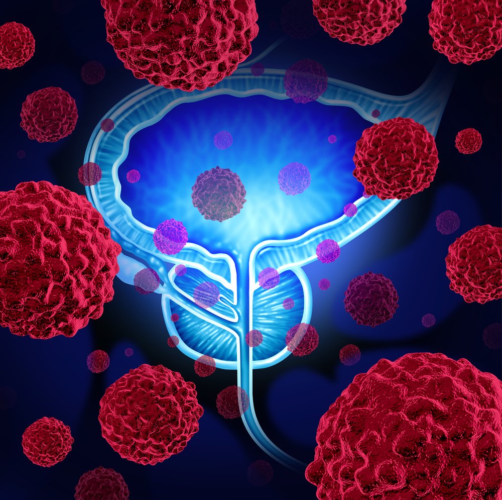WeillCornell's tweet photo. Researchers from @WCM_MeyerCancer and @MSKCancerCenter have identified a previously unrecognized form of hormone therapy-resistant prostate cancer. This discovery could open the door to the development of therapies that treat this specific disease.

https://t.co/Mp2cQ9EdAv https://t.co/1K8KO93ooA
