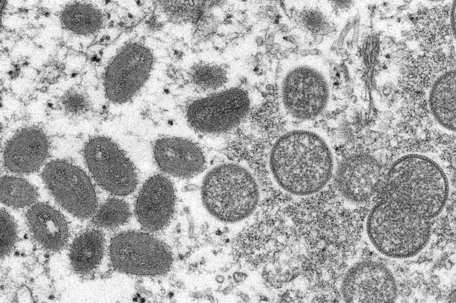 TrenchTimes's tweet photo. Monkeypox is a virus that is spread through close physical contact with bodily fluids.

https://t.co/0KCLc4PqAT https://t.co/GHVDCqzIDV
