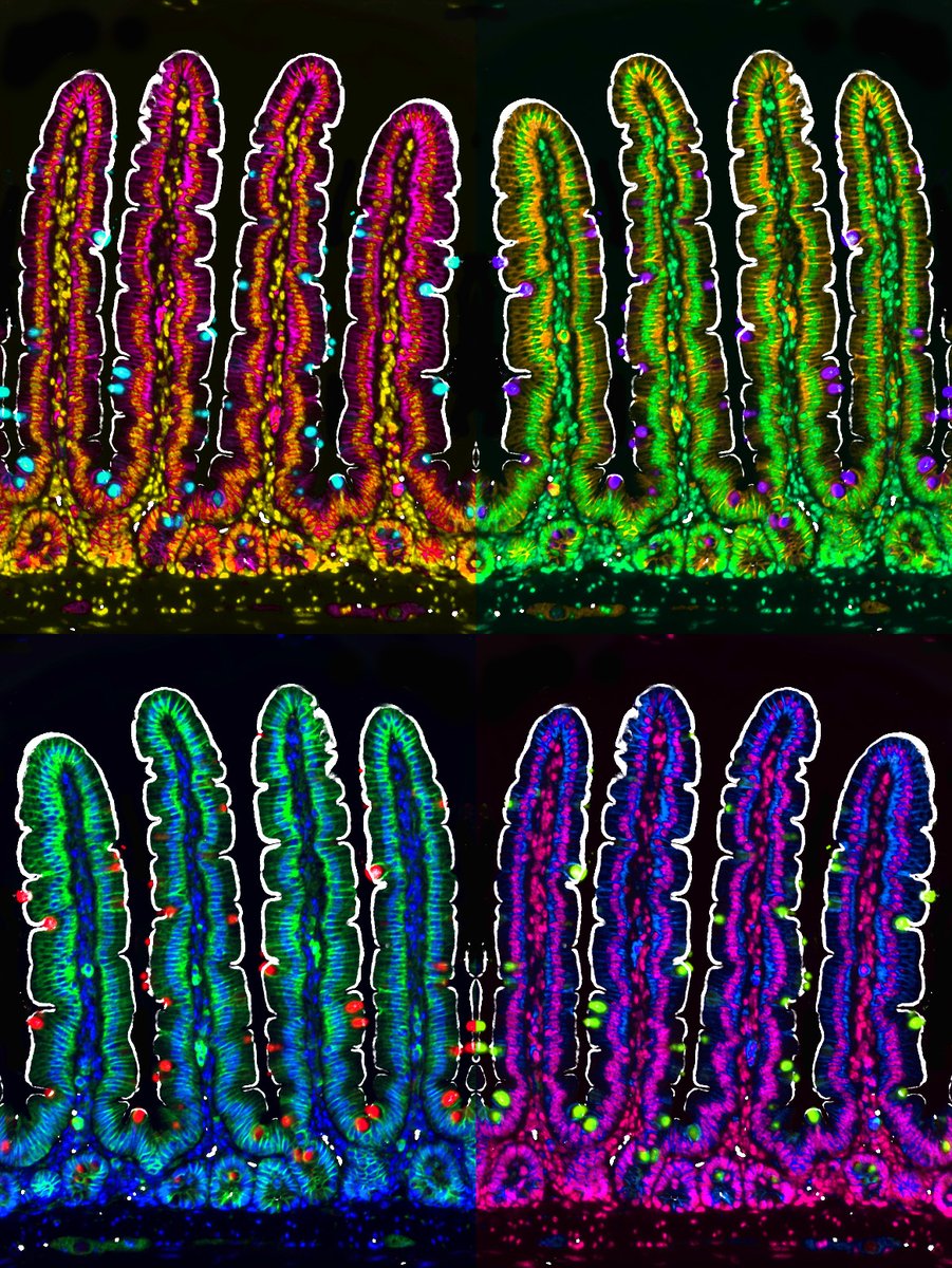 Enjoying my 🌈🔬#FluorescenceFriday with the fam in California after a fantastic #DDW2022. 

#bioart #sciart #GITwitter #histoart #pathart #microscopy #sisterlab