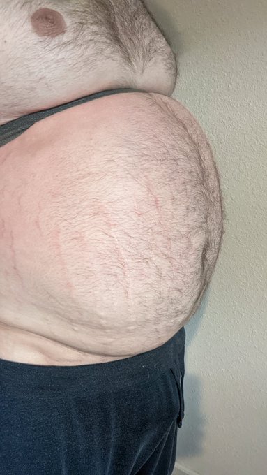 I tried something new. No video, but here's some photos. I inflated my chest with N2O. I started with