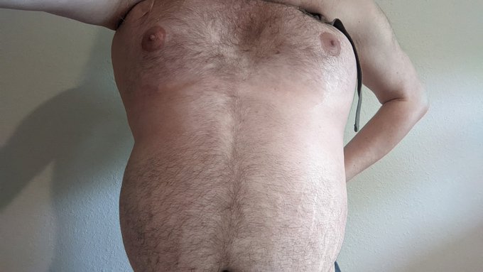 I tried something new. No video, but here's some photos. I inflated my chest with N2O. I started with