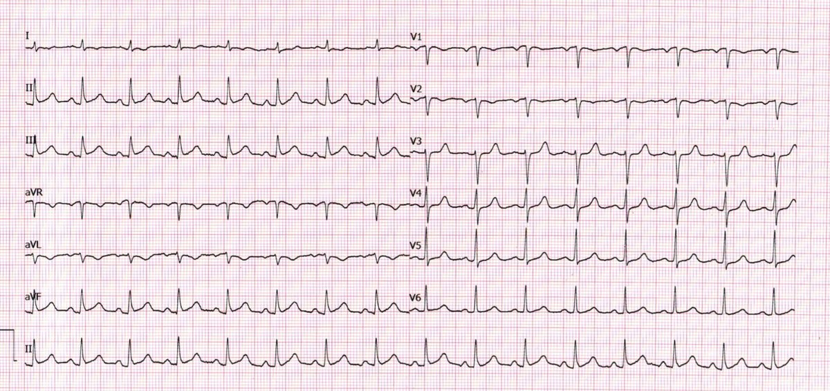 Emre Aslanger tweet media