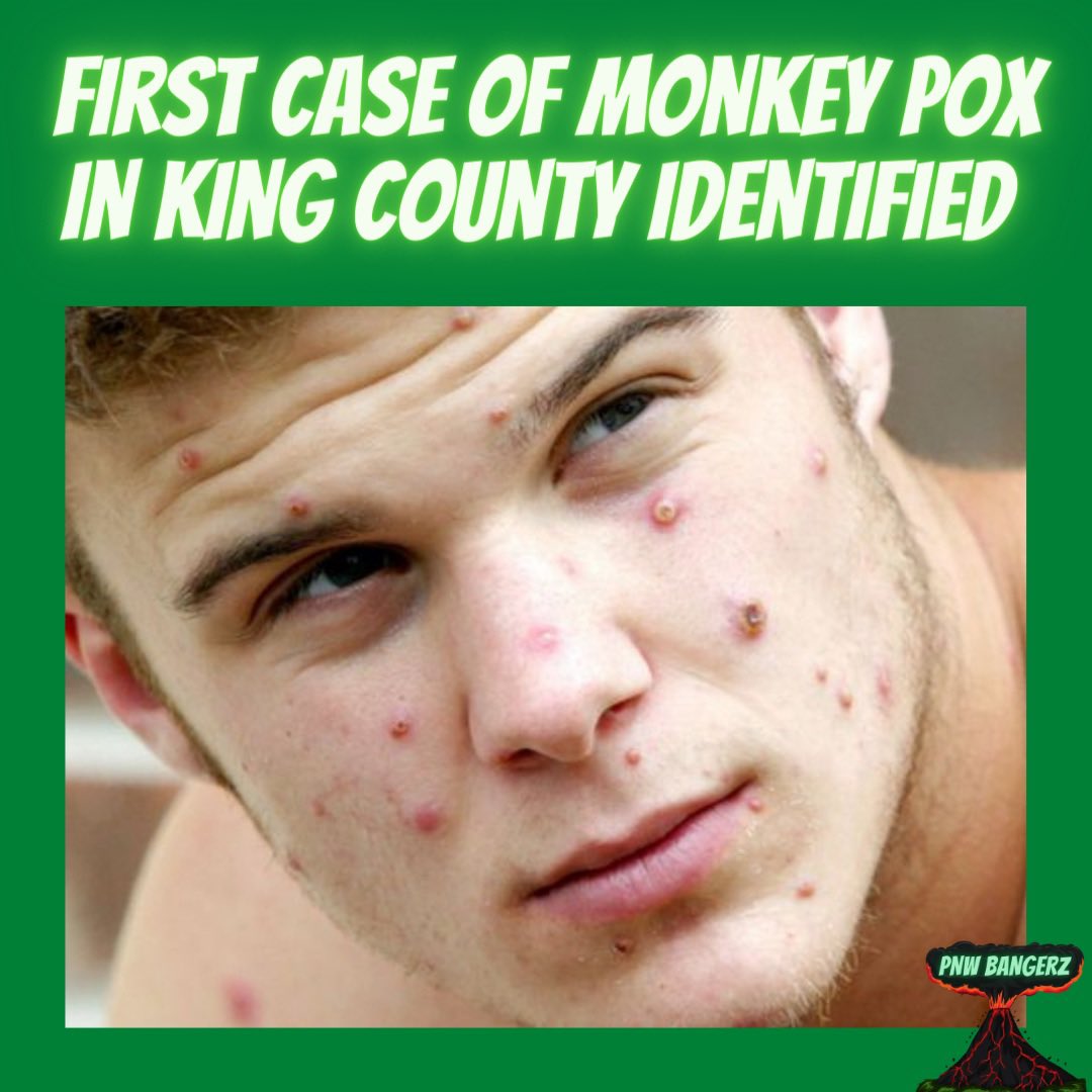 PNWBangerz's tweet image. First case of the #MonkeyBox identified in the area. #Seattle #PNWBangerz