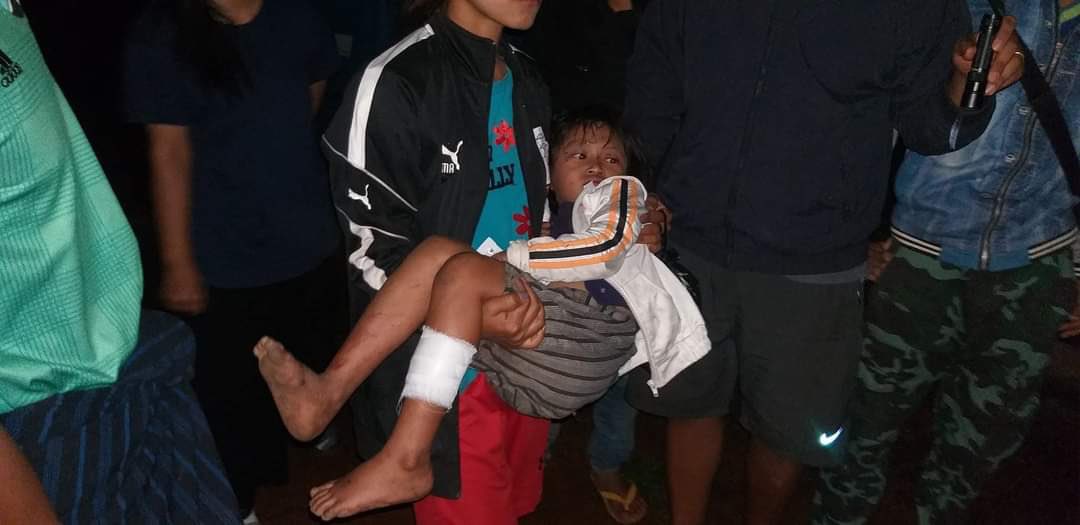 Tiam1702's tweet photo. The junta army’s artillery landed in Demoso township on Friday has killed a villager and injured three people, including five year old and 14 year old children in Kayah state of Myanmar. 
#2022Jun11Coup #WarCrimesOfJunta #WhatsHappeningInMyanmar https://t.co/aWT6hsOwQE