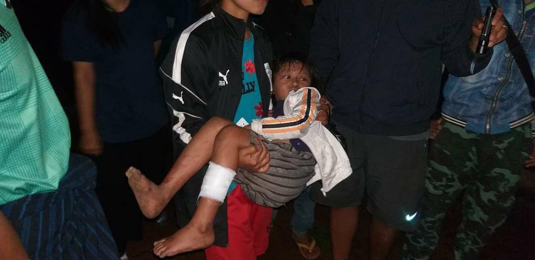 BryanOC55893120's tweet photo. Tw // Sensitive Contents,
SAC troops from battalion 102 shelled artilleries to Saungdular village, Demoso tsp, Karenni state last night, resulting in death of a resident and injuring of 3, according to Demoso-PDF. #2022Jun11Coup #WarCrimesOfJunta #WhatsHappeningInMyanmar https://t.co/Cclq7U0PWO