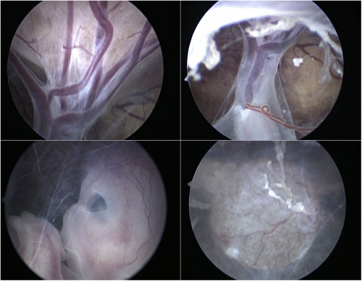 AJOG_thegray's tweet image. Images in Obstetrics &amp;amp; Gynecology:  Human embryo at 10 weeks’ gestation ow.ly/9RrP50Jvjas