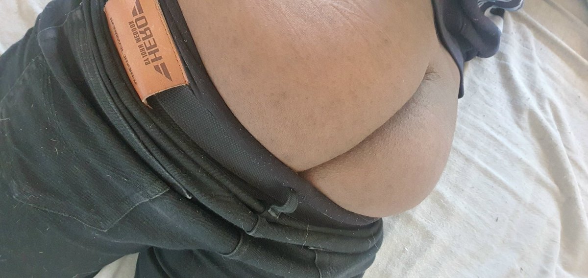 FrenchBigButt1's tweet photo. Pants too tight https://t.co/JKBlSE6v2I