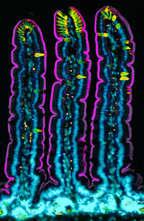Claudin 4 staining in yellow identifying some enteroendocrine cells and enterocytes at the tips of villi.  Villin is labeled in purple and nuclei are blue. 

#MicroscopyMonday #pathart #histoart #micrscopy #fluorescence