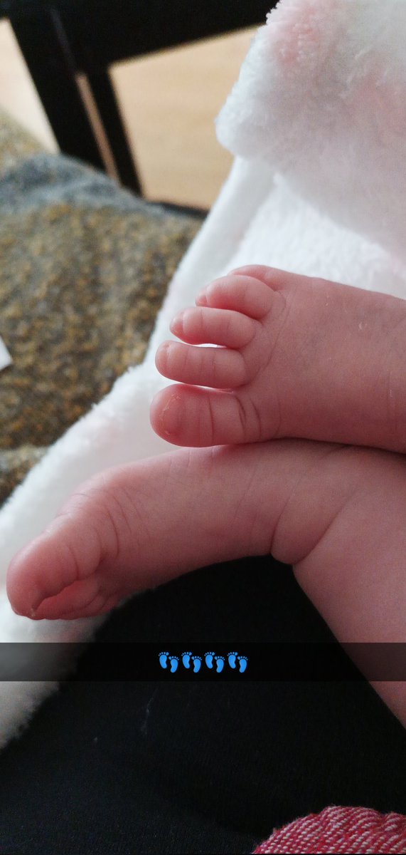 OTJo19's tweet photo. These little feet 😍😍 #newborn #mumof2girls https://t.co/QFiqkKM1b5
