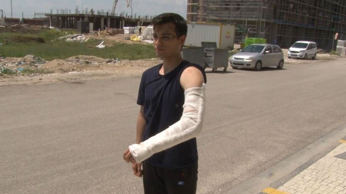 #Edirne’de üniversiteye bisikletiyle gittiği sırada başıboş köpeklerin saldırısına uğrayan üniversite öğrencisi hastanelik oldu
internethaber.com/bu-yil-icinde-…