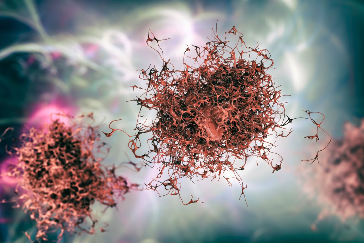 2APharma's tweet photo. #Breast, #lung, and #colon #cancer are the most common types of cancer. They have been shown to overexpress the epithelial cell adhesion molecule (#EpCAM), a transmembrane glycoprotein. When it's overexpressed, it can transform normal cells into cancer cells. 

#lifesciences https://t.co/NKN7ejYbfO
