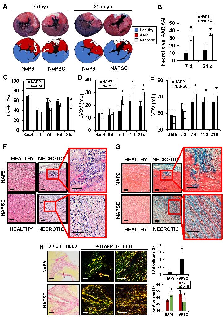 CircImaging (@circimaging) on Twitter photo NAP9: a brand new paramagnetic nanoparticle that induces cardiac protection in pigs subjected to acute myocardial infarction ahajournals.org/doi/abs/10.116… #AHAJournals <a href="/cardiomedufv/">C.ZARAGOZA CARDIOMED</a> <a href="/UFVinvestiga/">Investigación UFV</a> <a href="/yomolomas1/">Carlos Zaragoza</a> <a href="/AllisonGHaysMD/">Allison G. Hays, MD</a> <a href="/cshenoy3/">Chetan Shenoy</a> NAP9: a brand new paramagnetic nanoparticle that induces cardiac protection in pigs subjected to acute myocardial infarction ahajournals.org/doi/abs/10.116… #AHAJournals <a href="/cardiomedufv/">C.ZARAGOZA CARDIOMED</a> <a href="/UFVinvestiga/">Investigación UFV</a> <a href="/yomolomas1/">Carlos Zaragoza</a> <a href="/AllisonGHaysMD/">Allison G. Hays, MD</a> <a href="/cshenoy3/">Chetan Shenoy</a>