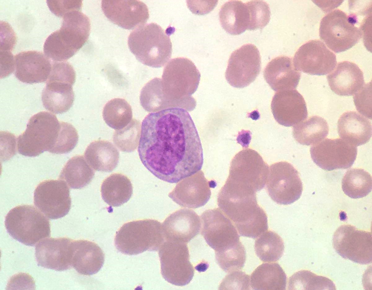 Fully committed and acquiring functionality! 6 days to open the abstract submission platform. #WeLoveNeutrophils