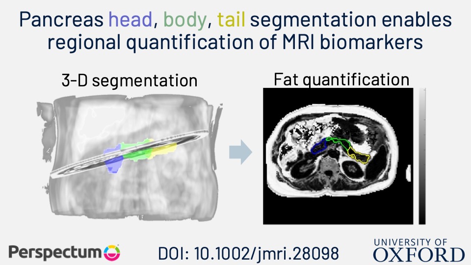 New Audioslide! Pancreas MRI Segmentation Into Head, Body, and Tail Enables Regional Quantitative Analysis of Heterogeneous Disease ow.ly/eo0350JqP2t