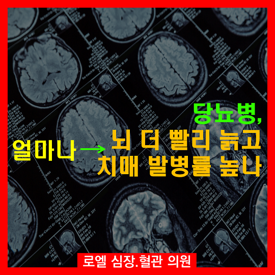 평범하게 나이들어 늙는 속도보다 빠르다면 ㅜㅜ 예방이 답이네 <당뇨병 있으면 뇌가 더 빨리 늙고, 치매 발병도 높인다>(연구) #심장혈관전문의 #로엘의원 #당뇨합병증  naver.me/I5ov3lko