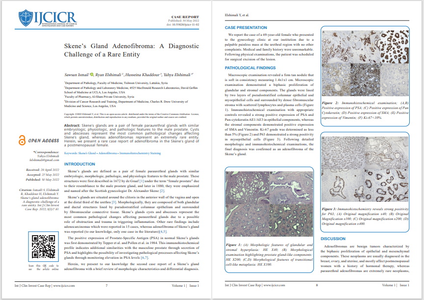 ijcicr's tweet photo. IJCICR has published a rare #casereport by John Yahya explaining the Diagnostic challenges of Skene’s Gland #Adenofibroma and how they overcome these challenges. Click to read full article - https://t.co/KNXI8E5iI5
#tumor #CancerResearch #callforpaper #medical #clinical #oncology https://t.co/fpfd9t7MBj