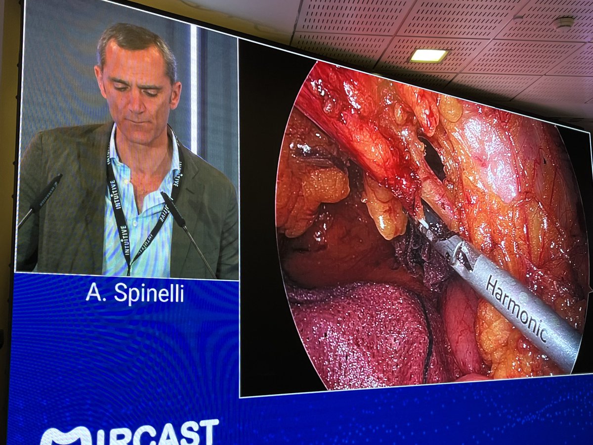 Eloy Espín (@eloiespin) on Twitter photo Enjoying in the MIRCAST meeting with so many friends and experts !!! Discussing about robotics, laparoscopy, ICA, ECA etc !!! Now hearing <a href="/AntoninoSpin/">Antonino Spinelli</a> Thanks to <a href="/M_GomezRuiz/">Marcos Gomez Ruiz</a> and <a href="/HUnivValdecilla/">Hospital Universitario Marqués de Valdecilla</a> colorectal team !!! Enjoying in the MIRCAST meeting with so many friends and experts !!! Discussing about robotics, laparoscopy, ICA, ECA etc !!! Now hearing <a href="/AntoninoSpin/">Antonino Spinelli</a> Thanks to <a href="/M_GomezRuiz/">Marcos Gomez Ruiz</a> and <a href="/HUnivValdecilla/">Hospital Universitario Marqués de Valdecilla</a> colorectal team !!!