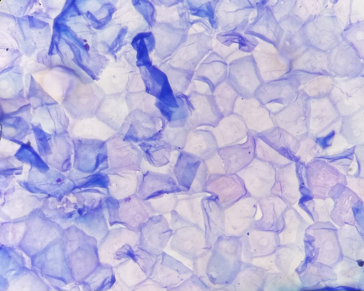 Alex Masucol on Twitter "RT LizaMQuintana Anucleate squamous cells