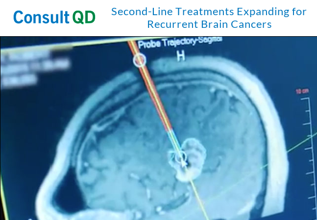 Cleveland Clinic Florida (@cleveclinicfl) on Twitter photo A once-discarded approach to #radiationtherapy for #braintumors has re-emerged as a solid secondary treatment.
<a href="/BorgheiRazaviMD/">Hamid Borghei-Razavi, MD, FACS</a> shares why it's important we have additional modality for patients with refractory disease: cle.clinic/39aUMz8 #braincancer A once-discarded approach to #radiationtherapy for #braintumors has re-emerged as a solid secondary treatment.
<a href="/BorgheiRazaviMD/">Hamid Borghei-Razavi, MD, FACS</a> shares why it's important we have additional modality for patients with refractory disease: cle.clinic/39aUMz8 #braincancer