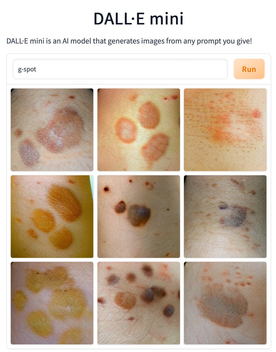 According to #dalle, the g-spot DOES exist (as a skin condition). Definitely the strangest result so far imo.

#dallemini