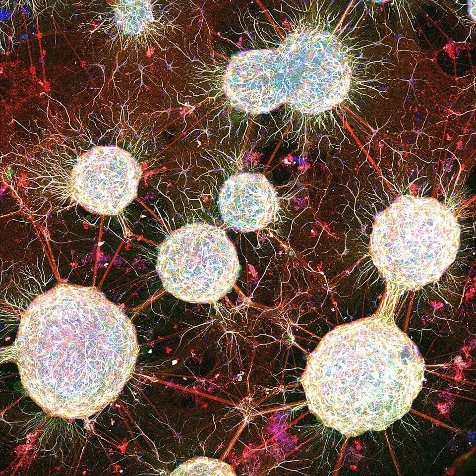 Joseph Gogos Lab (@gogoslabzmbbi) on Twitter photo An in vitro model of neuronal ensembles.
nature.com/articles/s4146…
Developing quantitative in vitro models of schizophrenia-related network dysfunction caused by two highly penetrant risk mutations in SETD1A and 22q11.2 loci, with potential for accelerating drug discovery An in vitro model of neuronal ensembles.
nature.com/articles/s4146…
Developing quantitative in vitro models of schizophrenia-related network dysfunction caused by two highly penetrant risk mutations in SETD1A and 22q11.2 loci, with potential for accelerating drug discovery