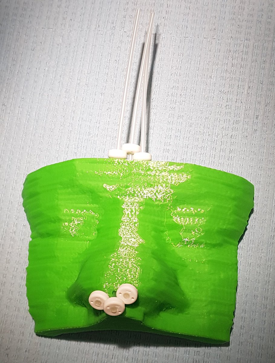 AdamChiche's tweet photo. Considering #3Dprinting surface #brachytherapy for #skincancer? Here you have a cheap #video-assisted detailed solution:
https://t.co/ecScb7uHkJ
https://t.co/ejJpuoWq3d
#ThisIsBrachytherapy #jocb #EducationalCorner https://t.co/hink0B7112