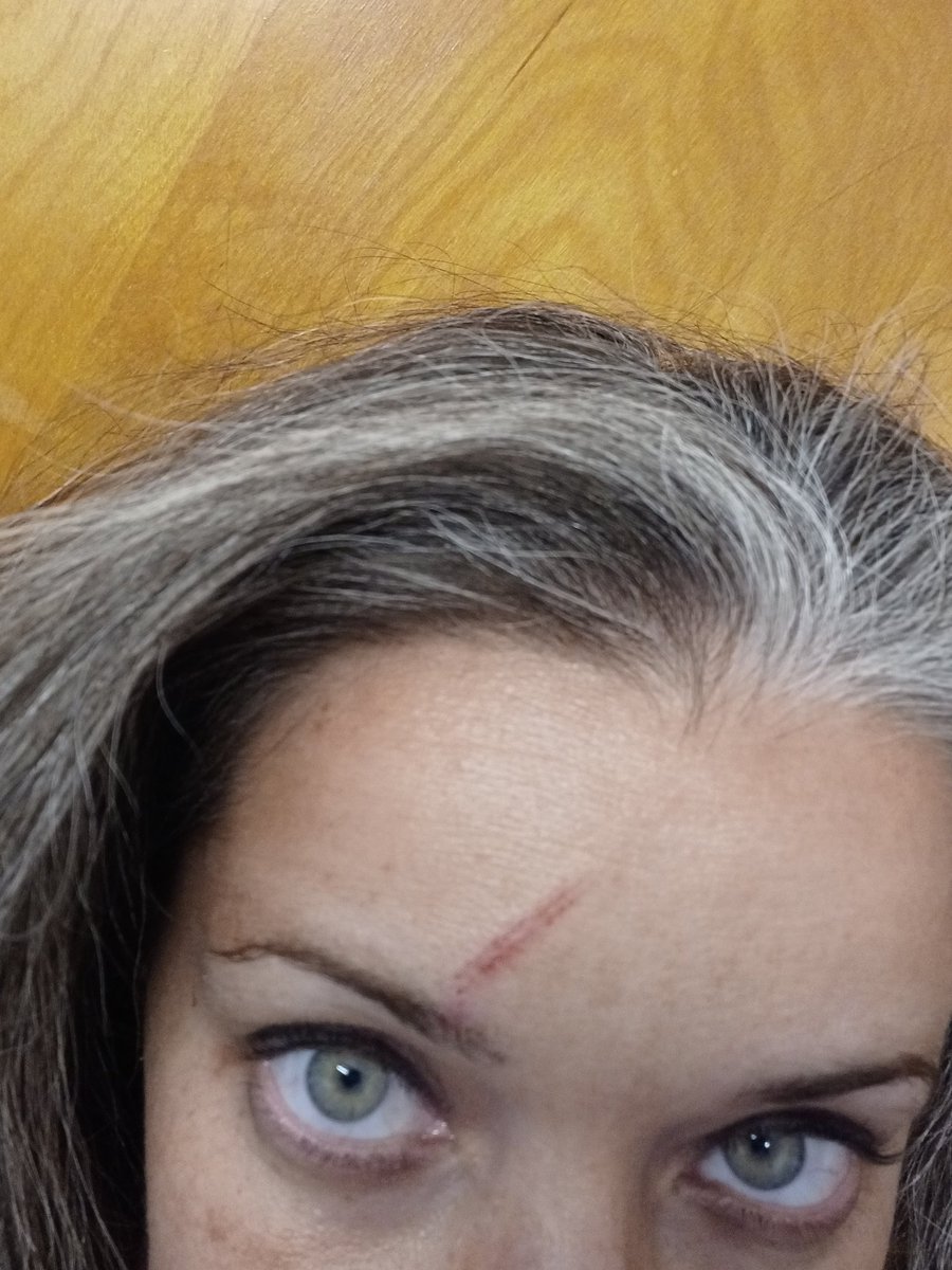 AnAMAZINGLiz's tweet photo. Little Jeremy was at it again... 

"Hey Coach,  play goalie for us"

If the gash on my forehead is still there for the 2125 Sheer Pleasure party at @15thAveAdult it was just a cleat to the head.  @LizardoJournal is not at fault... https://t.co/Zp3PCXyJcg