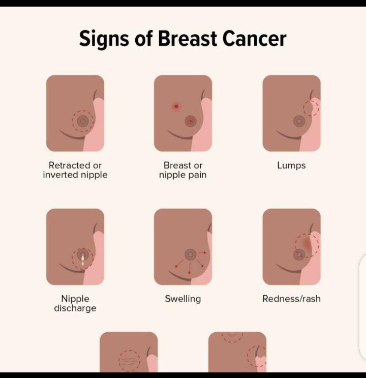 KKChemase's tweet photo. Let's Educate our Sisters avoid these useless Bras #Staycancerfree #WajackoyahThe5th https://t.co/7w4R8dZby7