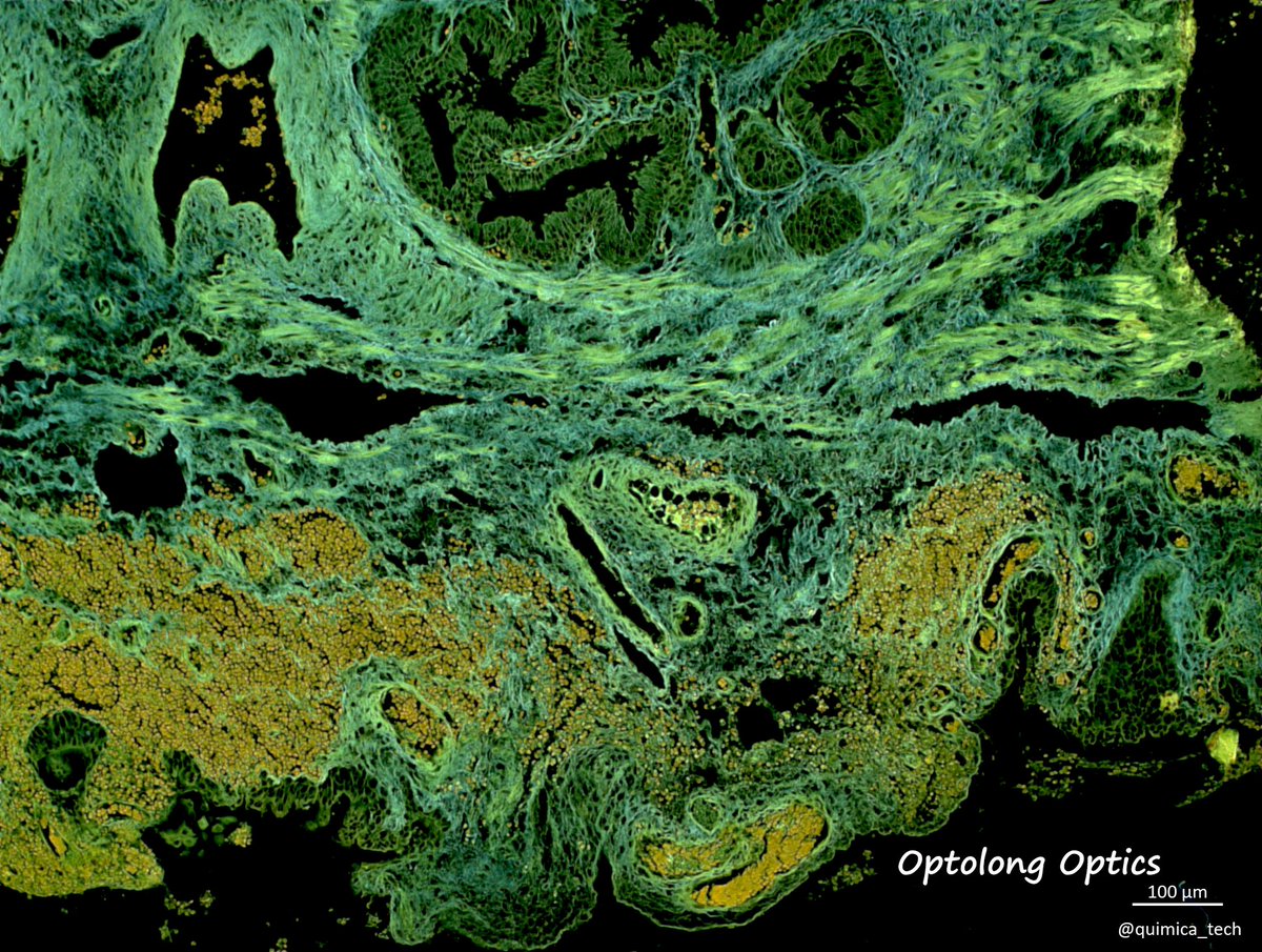 FLfilters's tweet photo. #FluorescenceFriday
#pathology sample of colon .The sample was stained with Harris Hematoxylin .
Photographer : Química Tech SA de CV
Filter set : DAPI Longpass filter Optolong
#Microscopy #Fluorescencemicroscope #pathologist #Opticalfilter #Fluorescencefilter #Olympuslifescience https://t.co/MvVDlSHUuk
